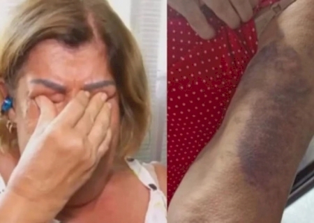 Professora espancada ao cobrar dever de casa está traumatizada: 'Medo'