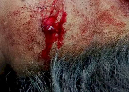 Mulher é baleada de raspão durante perseguição policial em MS
