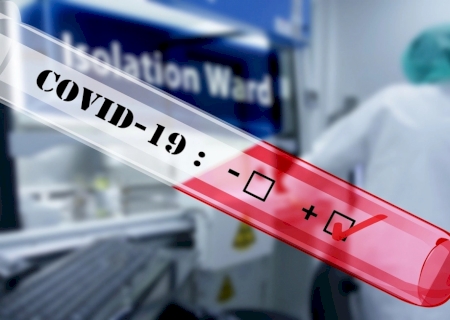 Deodápolis registra quase 50 casos de Covid-19 em 2025 e acende alerta para síndrome respiratória