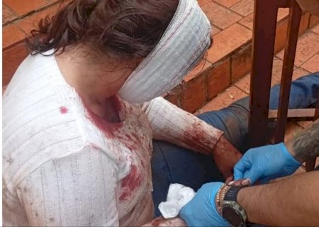 Mulher é atacada por pitbull ao defender cadela e é salva por sargento da PM
