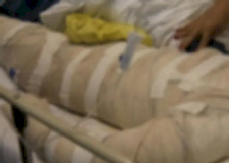 Adolescente que colocou fogo em menino com álcool é apreendido em MS